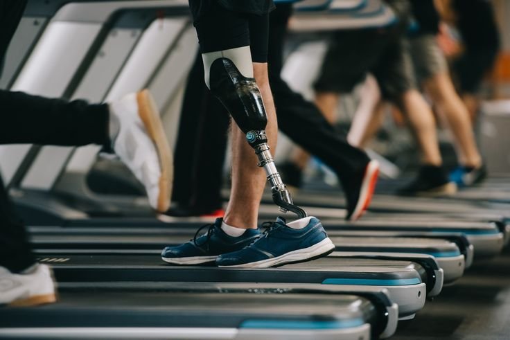 An man with a prosthetic leg at the gym in Stoneycroft, Liverpool