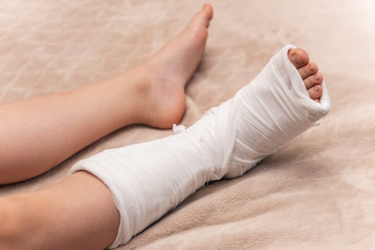 A broken leg and soft tissue injuries