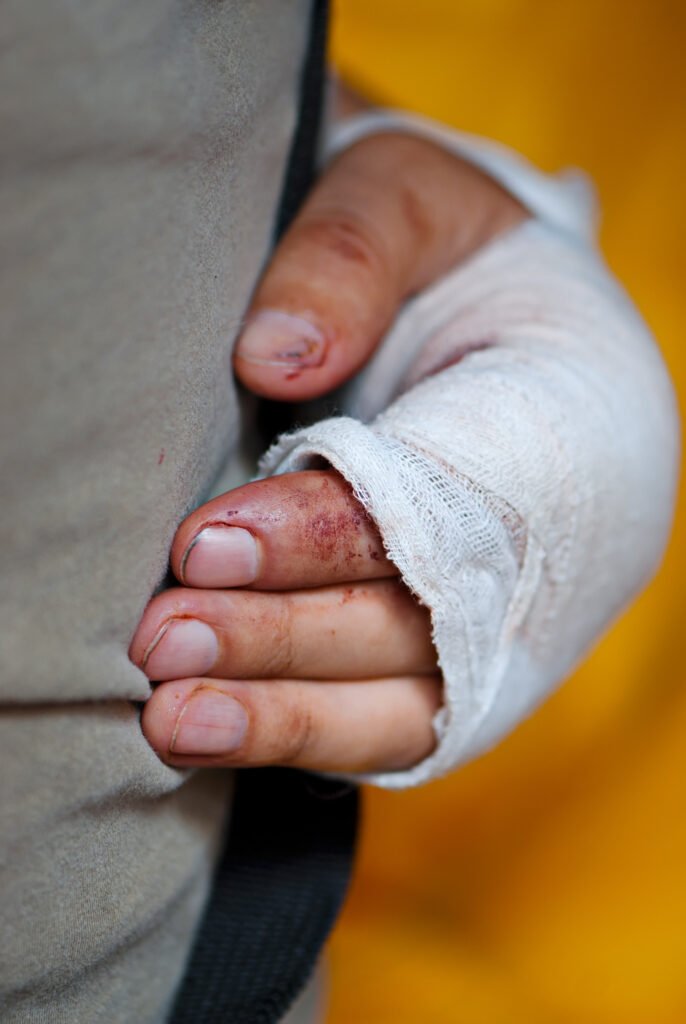 A close-up of a bandaged and bloodied hand