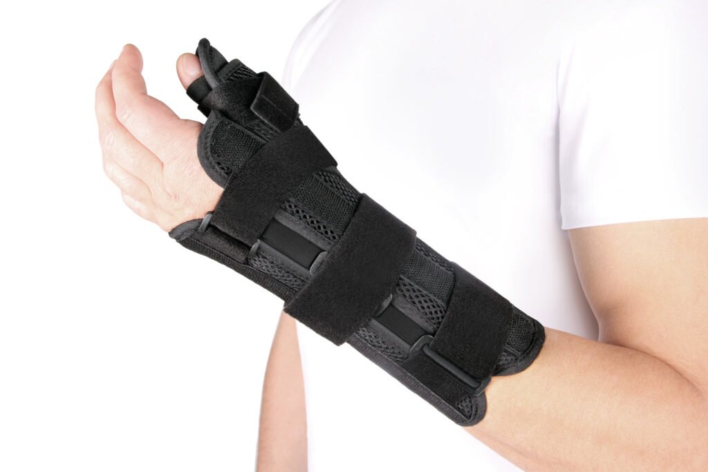 A hand in a cast to represent soft tissue injury claim for an injured hand.
